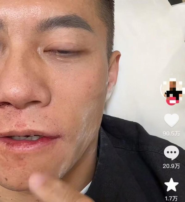 最新配资平台 扇耳光大赛倒地的中国选手再谈失利：不后悔上场，坚定了决心